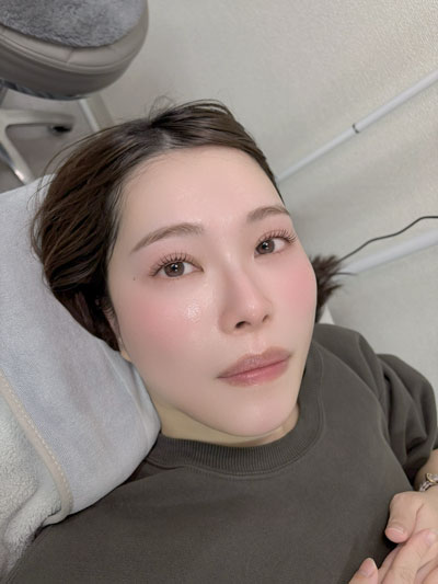 アンドヘルシーの施術例